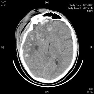 Neurocritical JC By @neuroclassroom